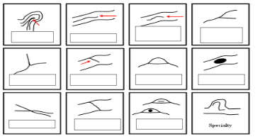 <p>Name the 12 minutiae characteristics?</p>