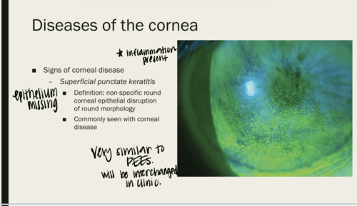 <p>non-specific round corneal epithelial disruption of round morphology</p>