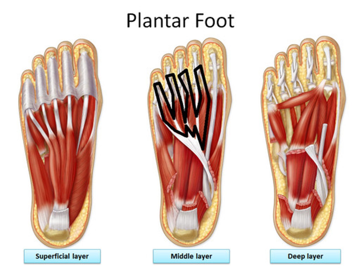 <p>Origin: medial borders of digital branches of flexor digitorum longus tendon</p><p>Inserion: dorsal aponeuroses of digits II-V</p><p>Action: flexes metatarso-phalangeal joints and extends interphangeal joints of digits II-V; adducts digit V</p>