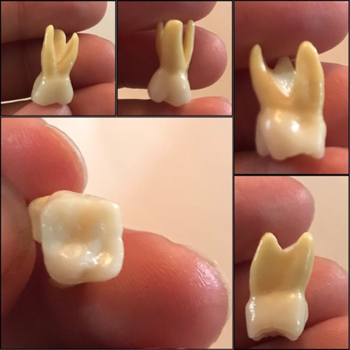 <p>What tooth is this ?</p>