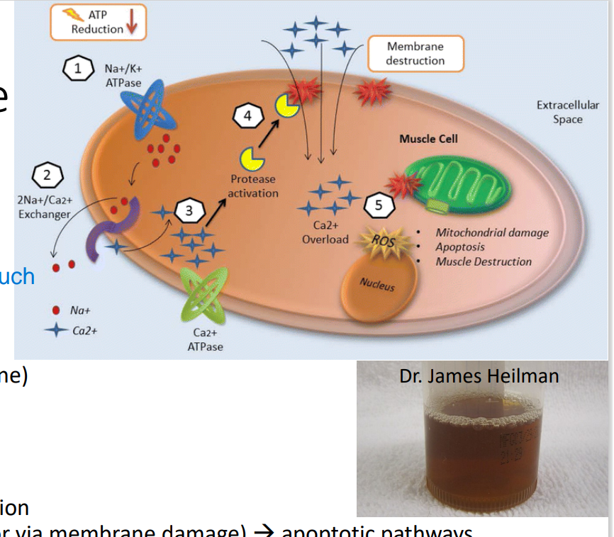 <p>Rhabdomyolysis</p>