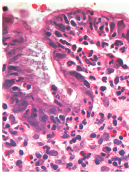 term image