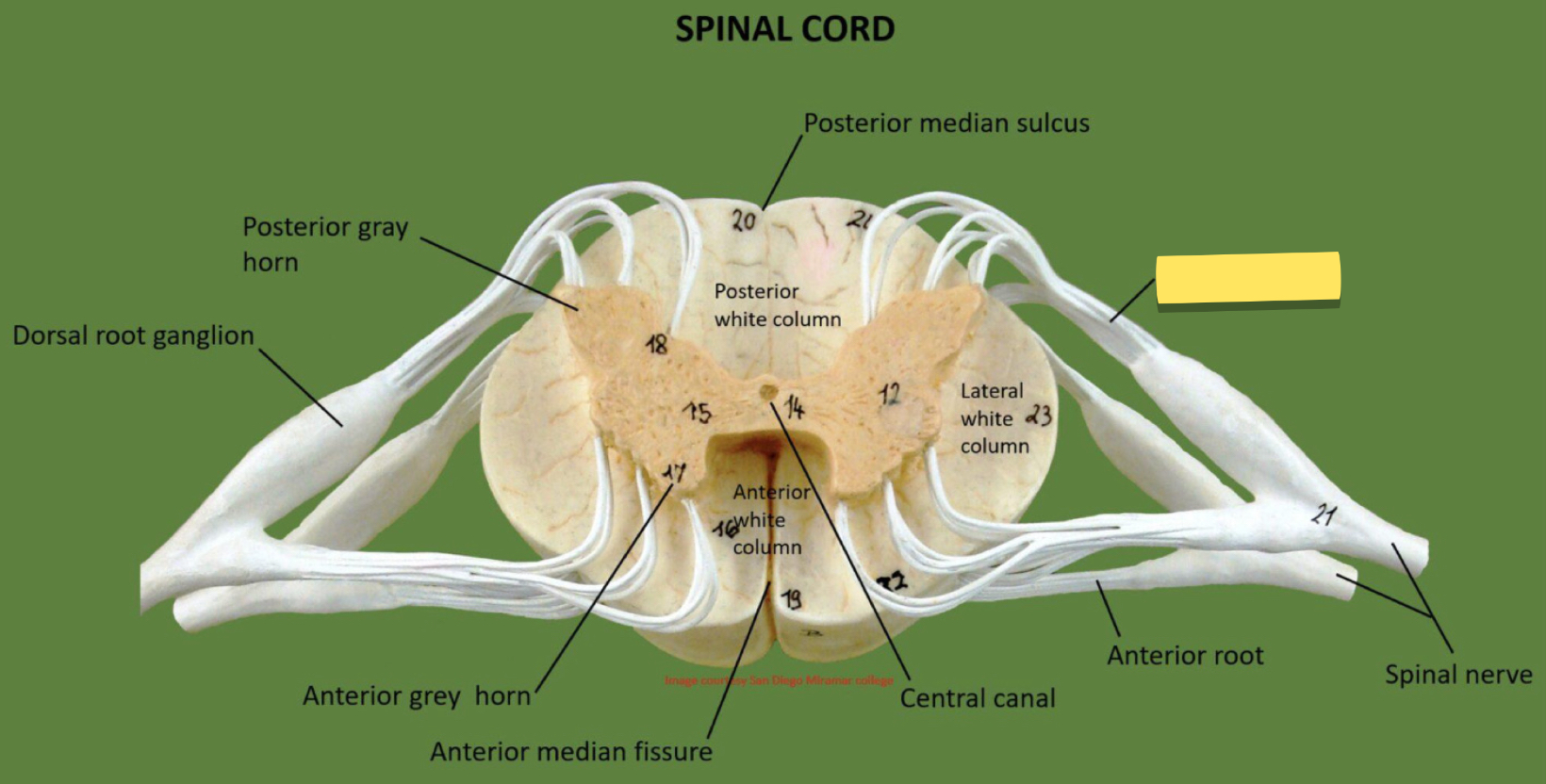 <p>Name this spinal cord part</p>