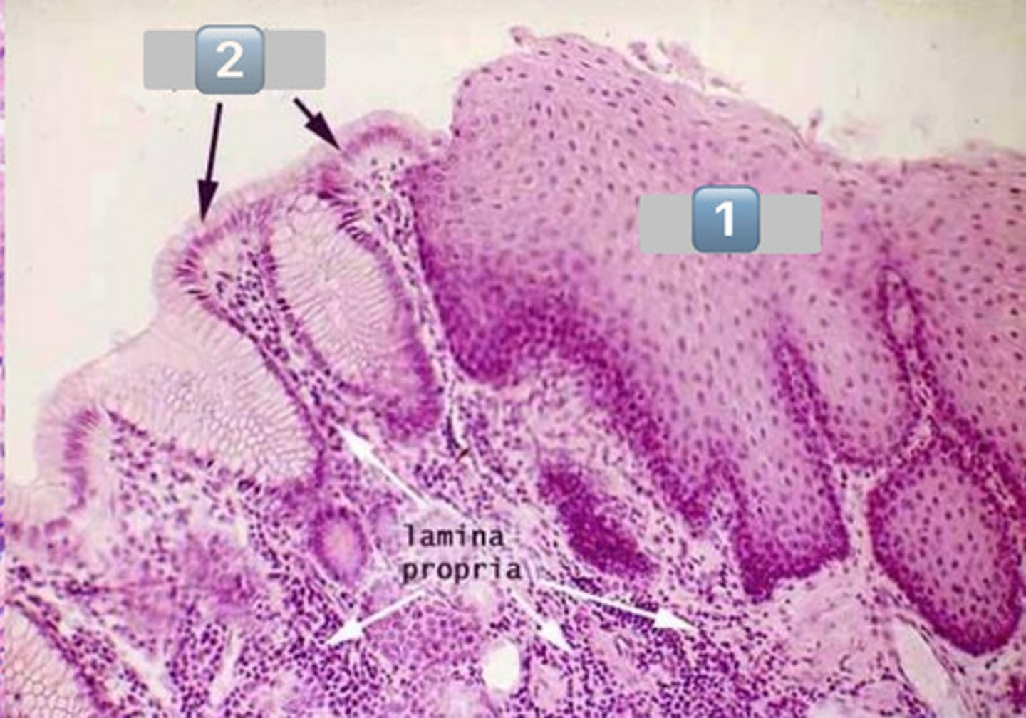 <p>esophageal epithelium</p>