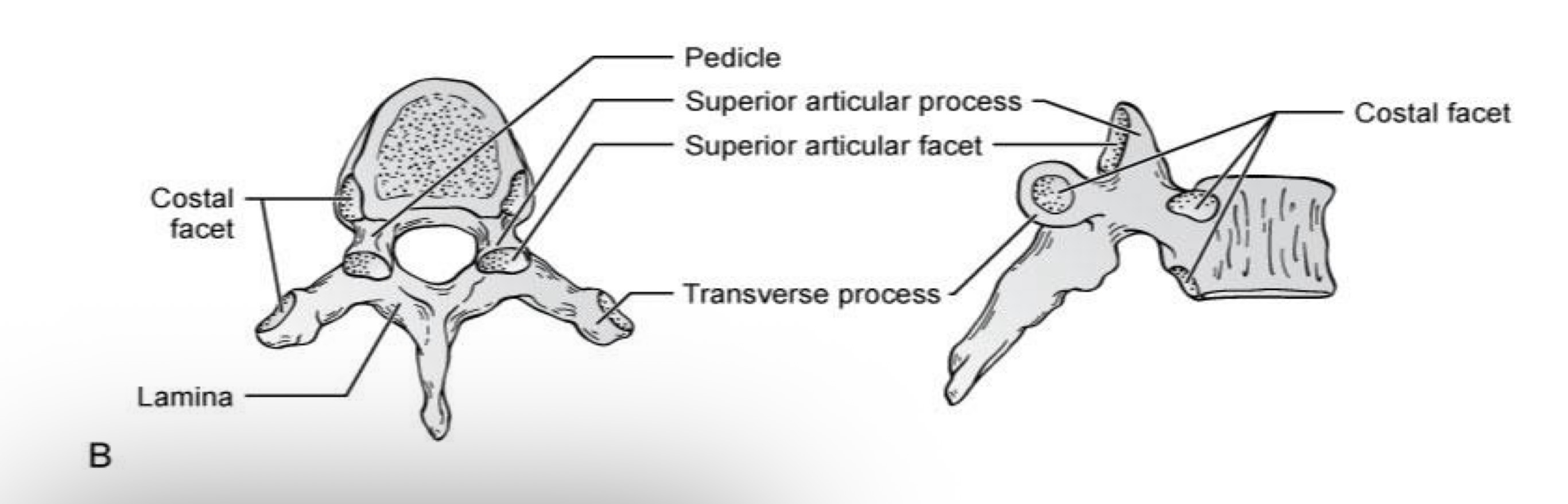 <p>What type of vertebrae is this?</p>