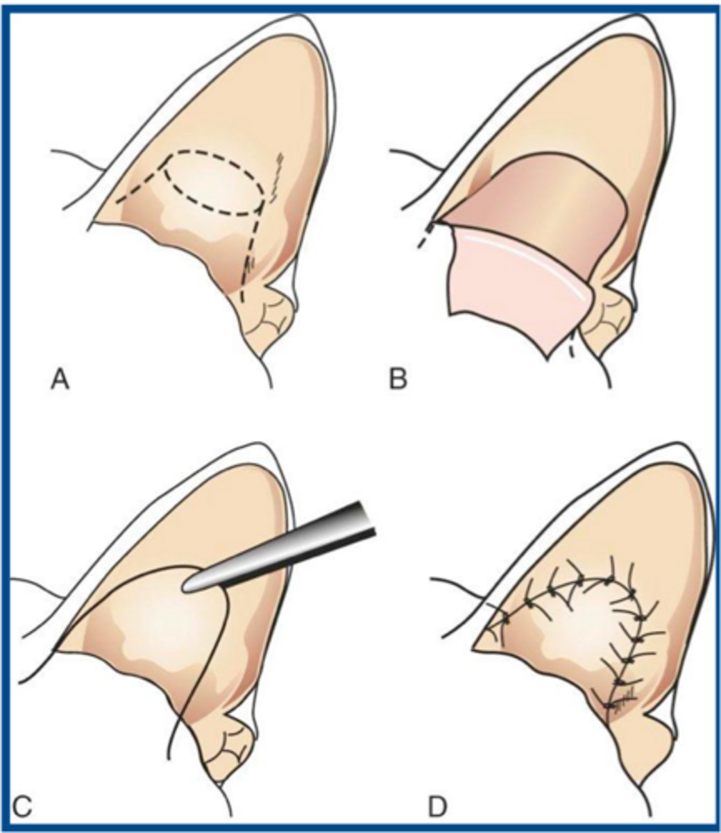 <p>what procedure is shown here</p>