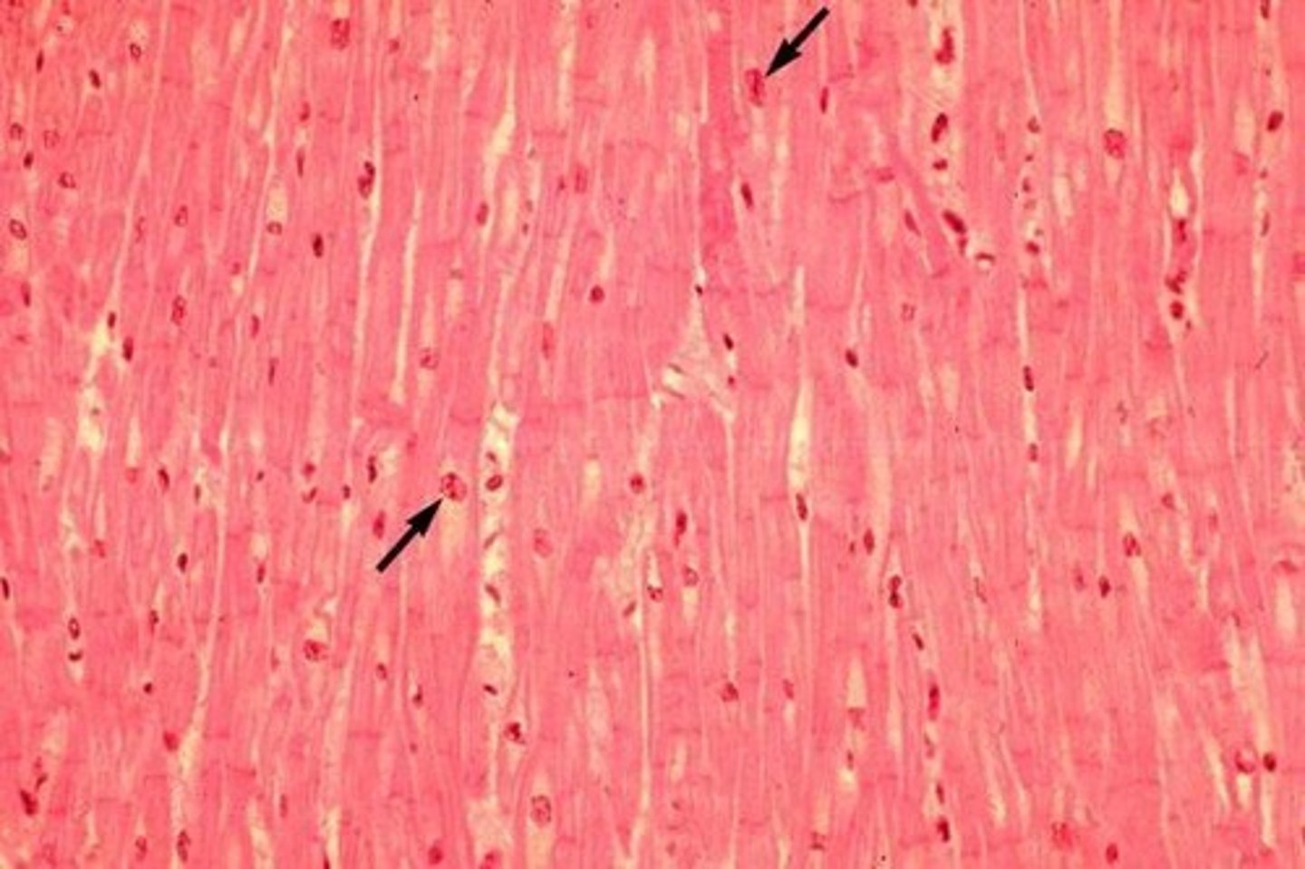 <p>what component of muscle tissue is this</p>