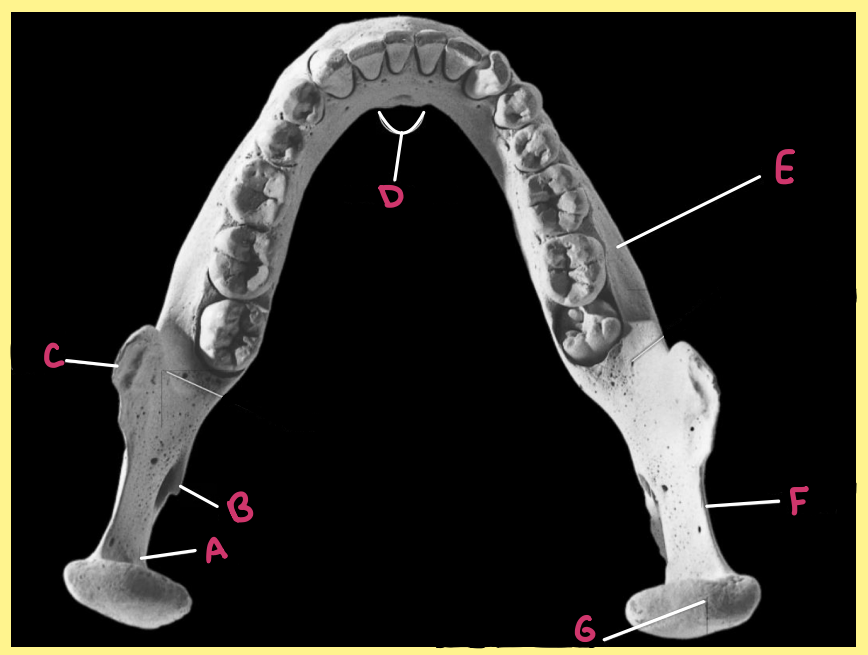 <p><u>Name the following</u>:</p><ul><li><p>Bone?</p></li><li><p>Side?</p></li><li><p>View?</p></li><li><p>A?</p></li></ul><p></p>