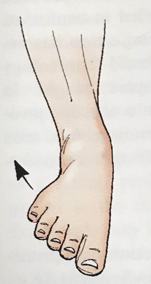 <p>Outward turning of the foot at the ankle</p>