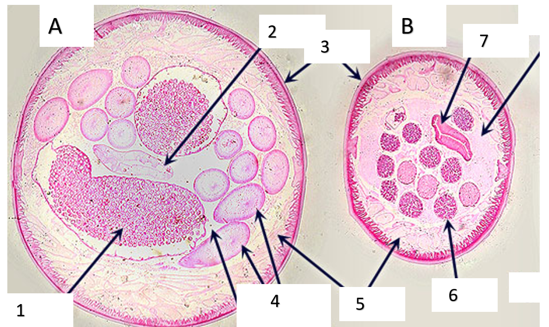 <p>Look at the two cross-sections of parasites and answer the questions.</p><ol><li><p>Which one is male A or B?</p></li><li><p>How do you know?</p></li><li><p>Based on the structure seen below, what phylum of parasite is represented?</p></li><li><p>Write numbers 1-7 and list the anatomical structures next to their number.</p></li></ol><p></p>