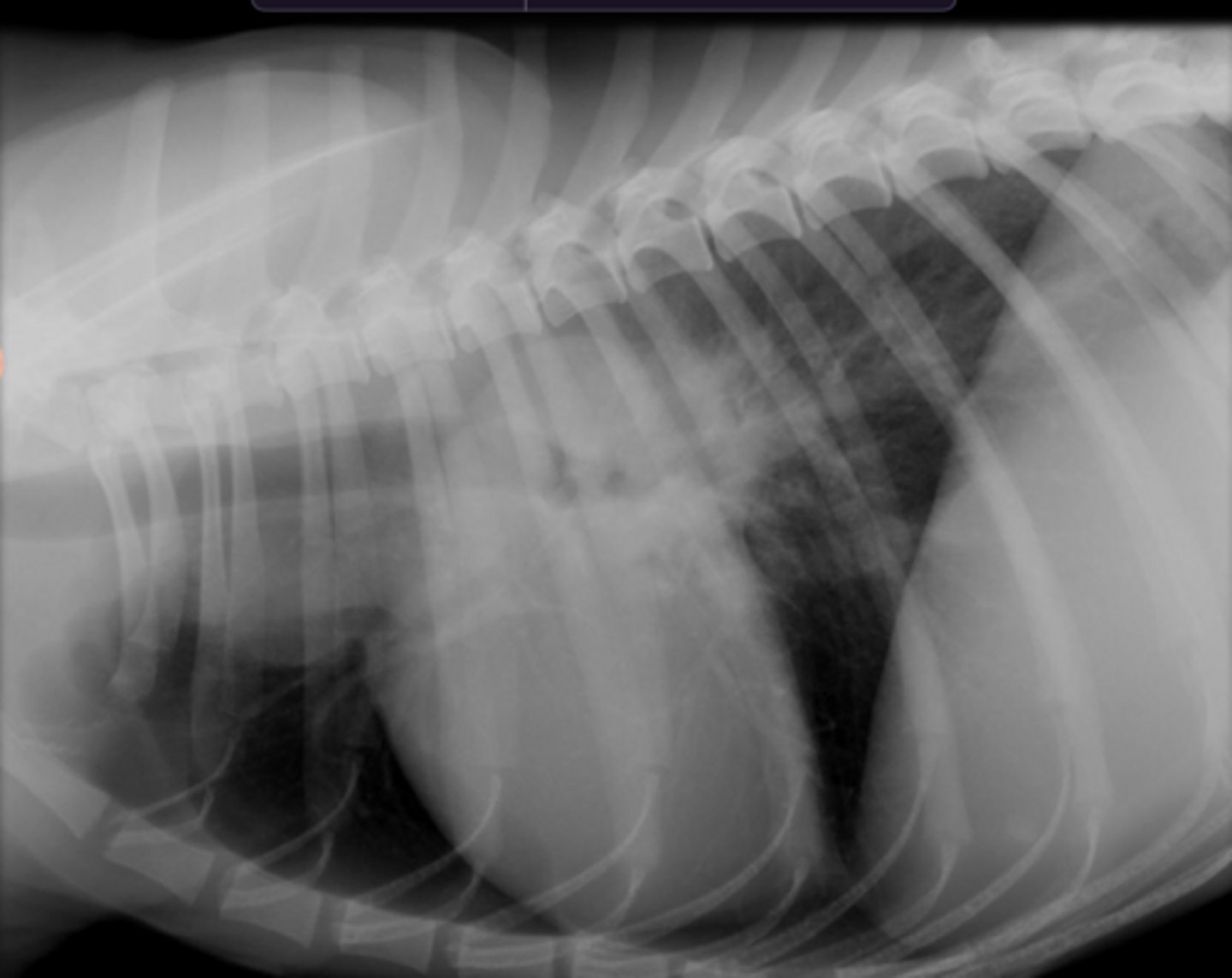 <p>What do you suspect given the following rad?</p>