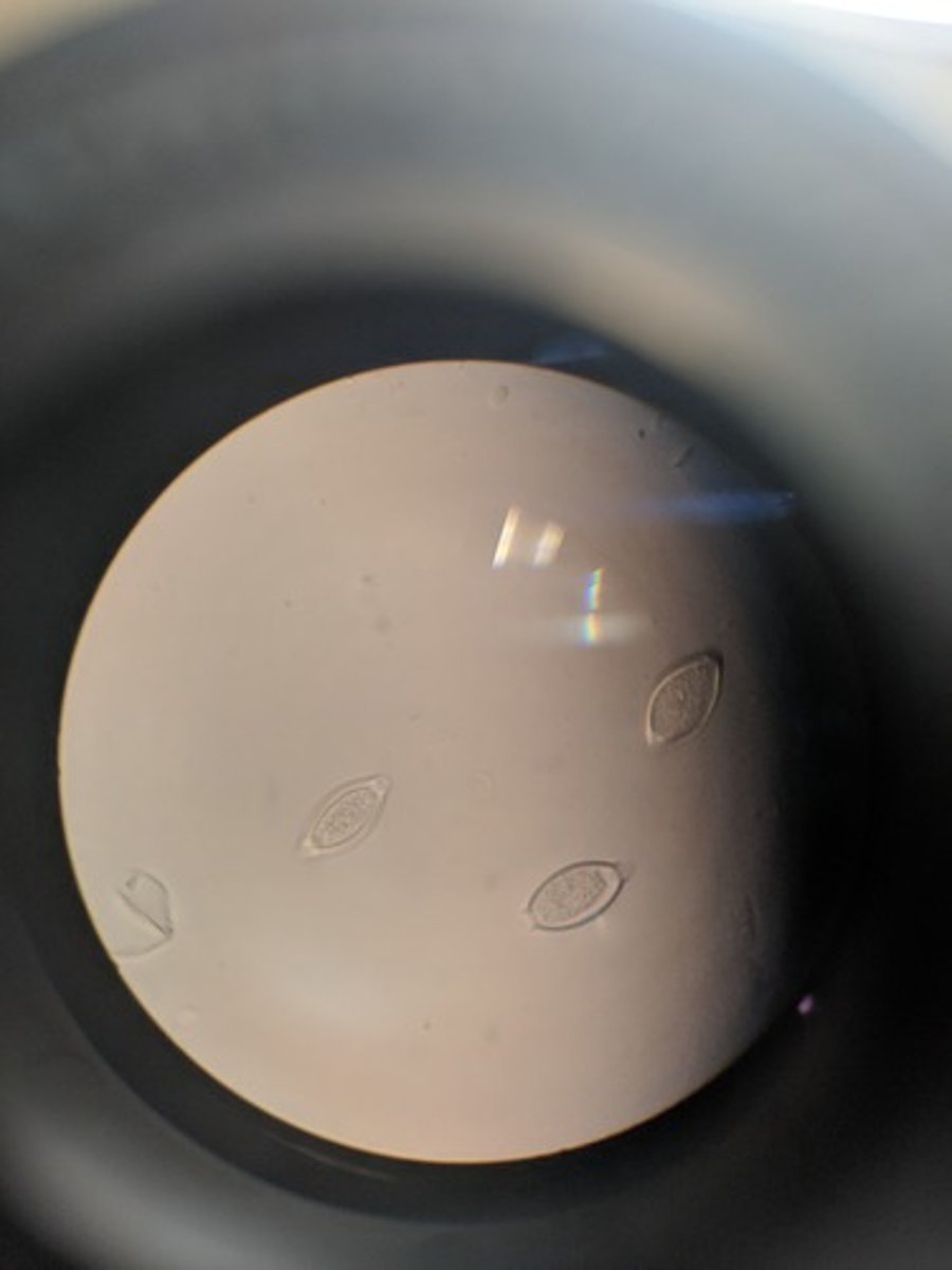 <p>has two pinched ends</p><p>eggs = infective form</p><p>dx: fecal exam for eggs</p><p>"whipworm"</p>