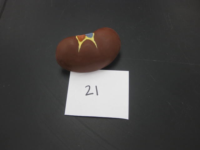 <p>Body Systems</p><p>Lab Image 1-28</p>