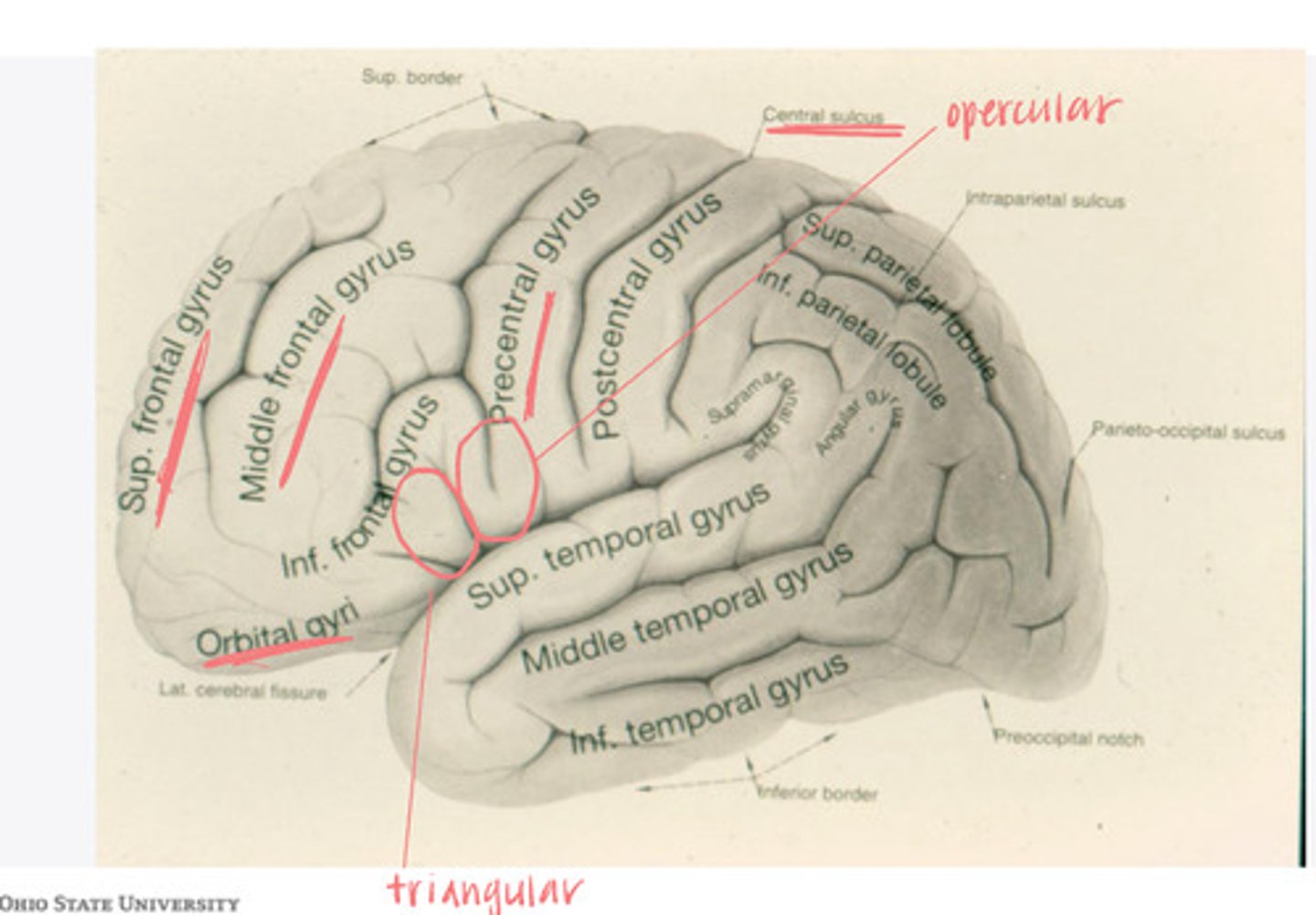 <p>What are the 3 divisions of the inferior frontal gyrus?</p>