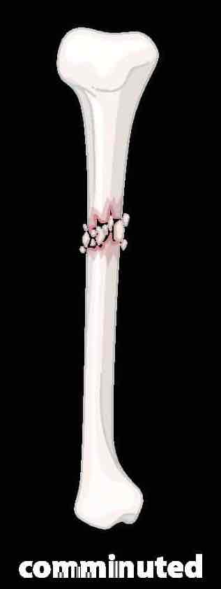 <p>Shattered into multiple pieces</p>