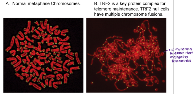 <p><span>A telomere is </span><strong>a region of repetitive DNA sequences at the end of a chromosome, forming a capped end structure that is associated with a T-loop</strong><span>. Telomeres protect the ends of chromosomes from becoming frayed or tangled and shorten with each division.</span></p>