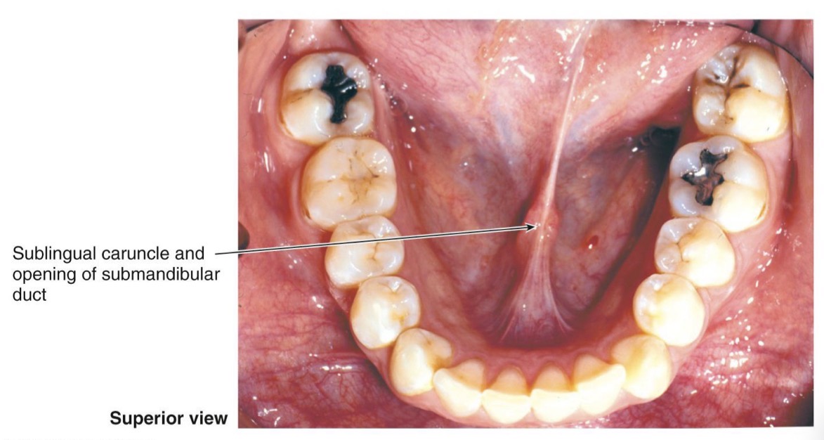 <ul><li><p>smooth and shiny appearance </p></li><li><p>non-keratinized stratified squamous epithelium</p></li><li><p>sublingual caruncle and opening of submandibular duct </p></li></ul><p></p><p>insert image from slide 10</p>