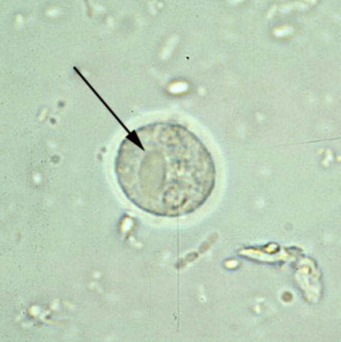 term image