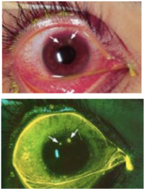<p>Eye trauma that is typically evident as a white/opaque spot with a penlight or direct inspection, will be round on staining</p>