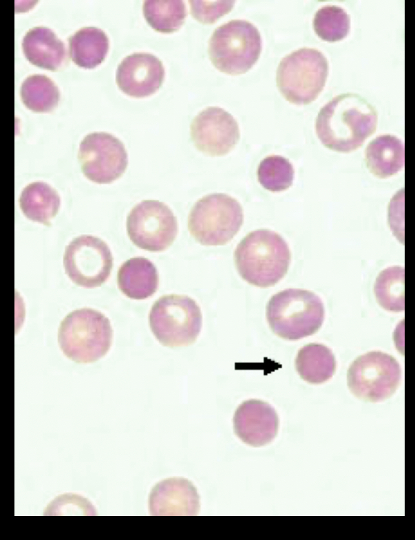 <p>What RBC is this? </p>