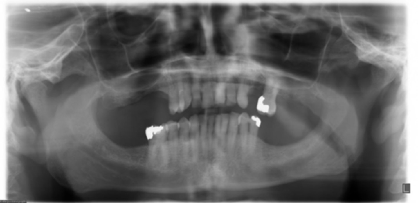 <p>ID the positional error from the radiograph:</p>