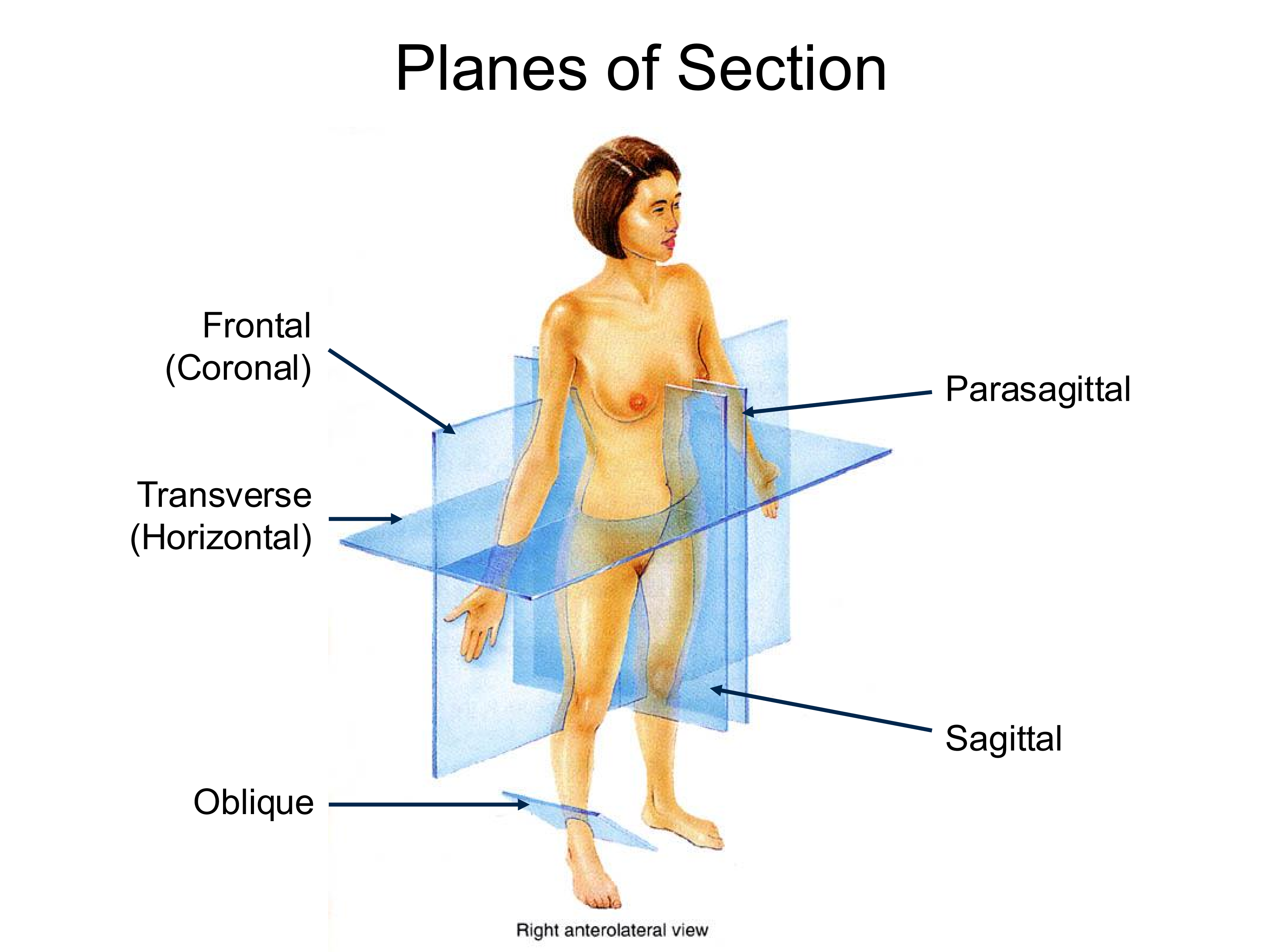 <p>splits the body into left and right sides</p>