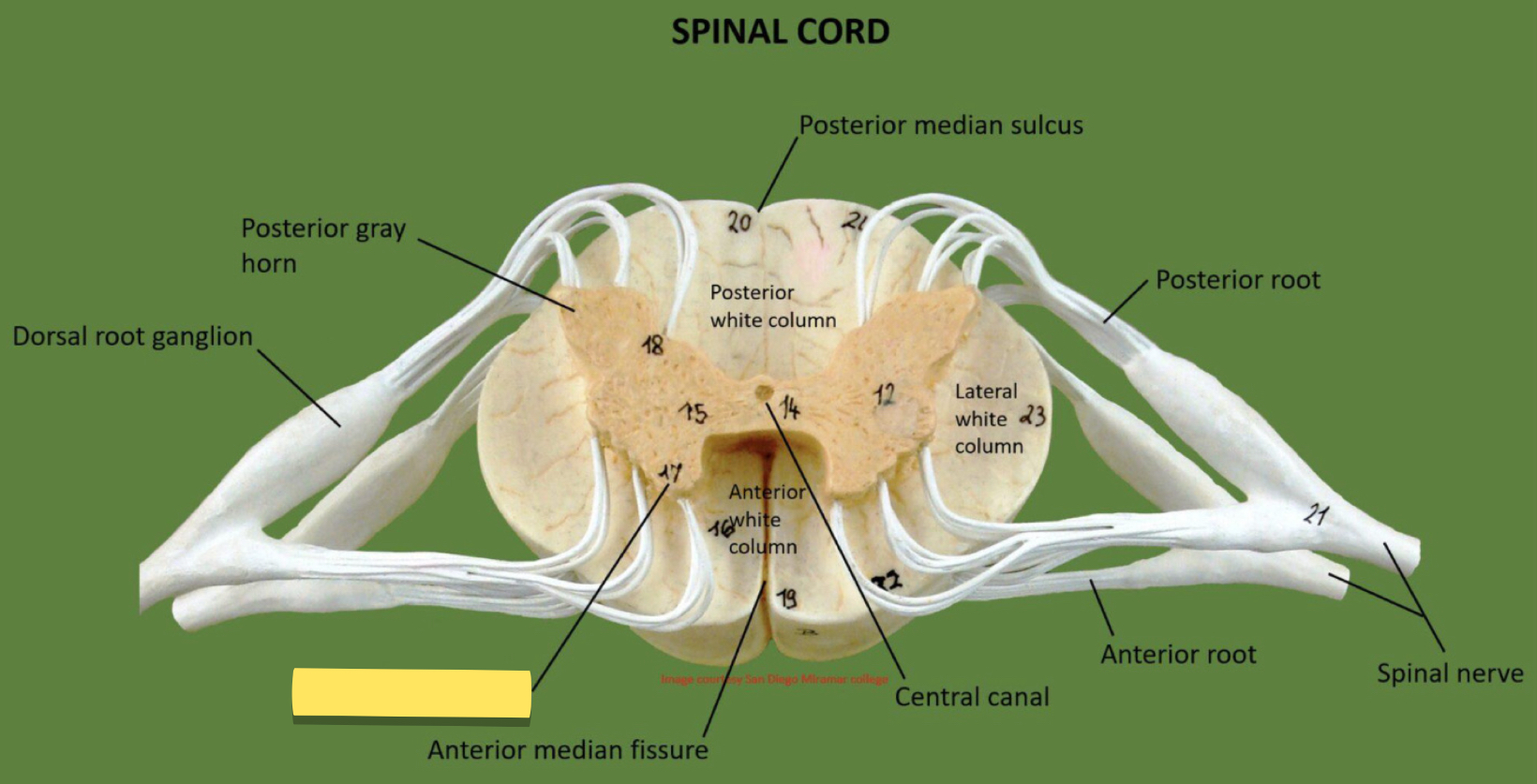<p>Name this spinal cord part</p>