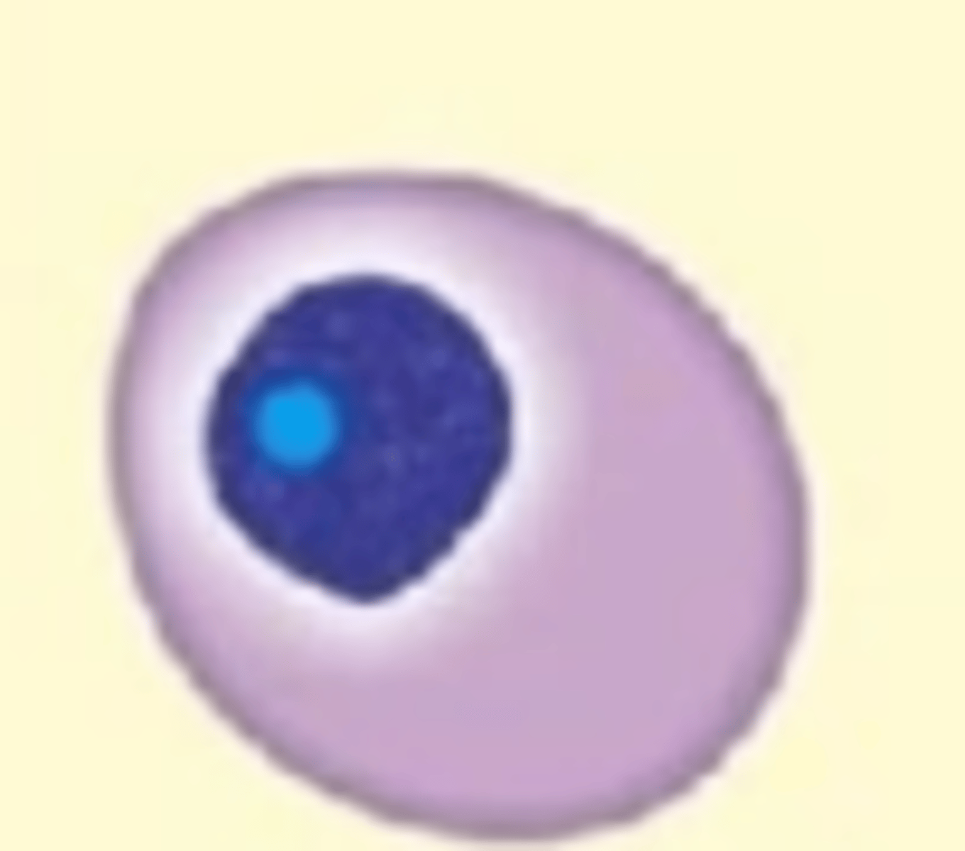 <p>Plasma cell variation</p><p>Have higher N:C ratio, finer, and more reticular chromatin, and have a lot more prominent nucleoli than mature plasma cells</p>