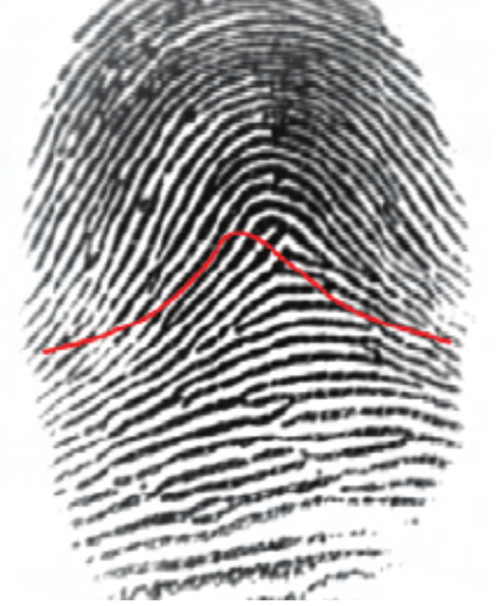 <ul><li><p>Raise in the middle with ridges entering and exiting both sides</p></li><li><p>No delta</p></li></ul><p></p>