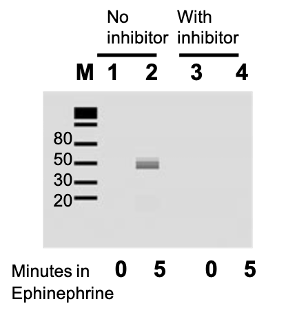 <p><span style="font-family: &quot;Times New Roman&quot;, serif"><strong>What do the results in lanes 1 and 2 tell you regarding what first needs to happen before </strong></span><span style="font-family: &quot;Segoe UI Symbol&quot;, sans-serif">b</span><span style="font-family: &quot;Times New Roman&quot;, serif"><strong> arrestin can bind to the receptor.</strong></span><span><strong>&nbsp;</strong></span></p><p></p>