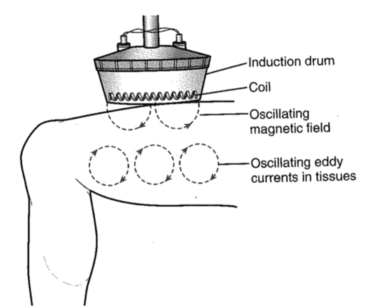 <p>Diathermy: Greek word meaning "through heat"</p><p>Shortwave: refers to the shortwave electromagnetic band of the electromagnetic spectrum. High frequency but short in wavelength</p>