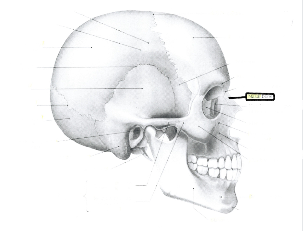 <p>Nasal bone</p>