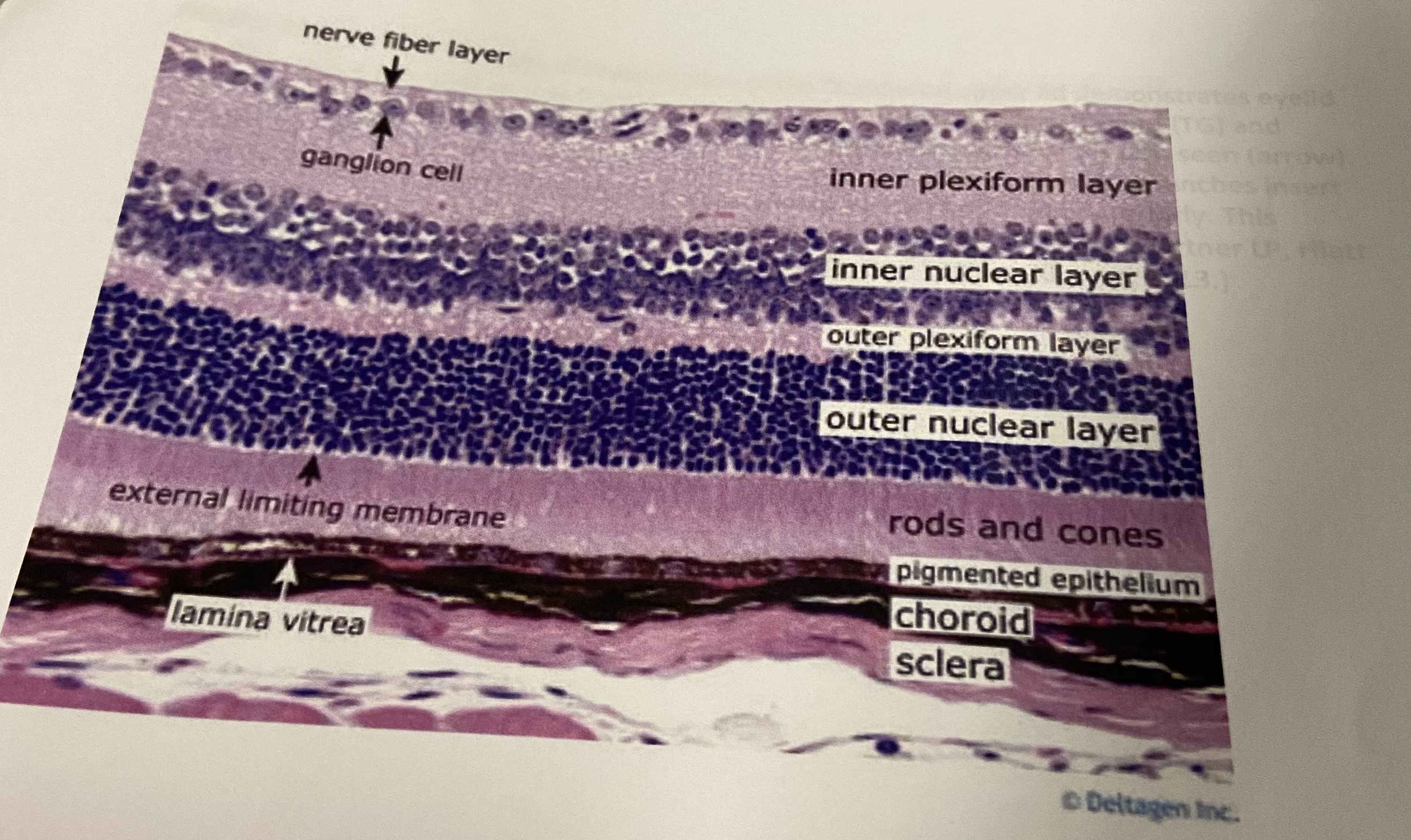 <p>1-inner nuclear layer 2-outer plexiform layer 3-outer nuclear layer 4- pigmented epithelium 5-choroid 6-sclera 7-lamina vitrea</p>