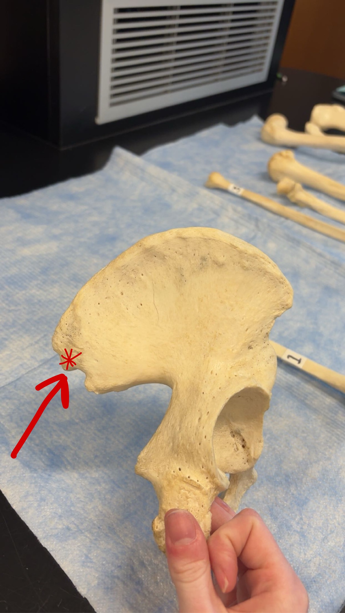 <p>Name this structure</p>