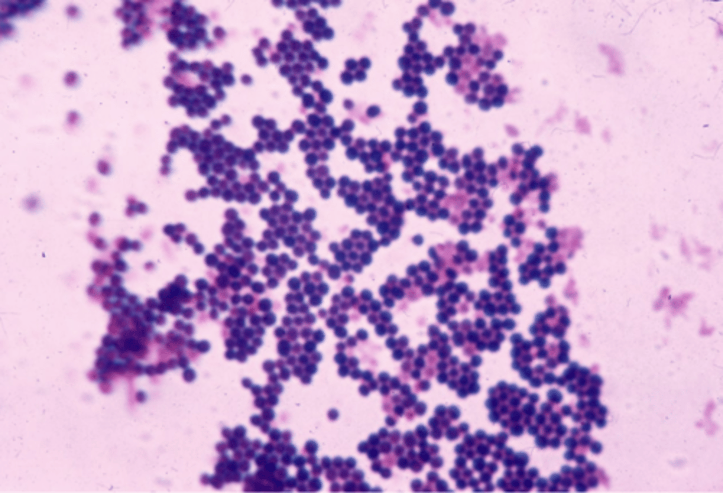 <p>Gram positive cocci clusters</p><p>Affects the skin</p><p>Causes pyoderma, abscesses, otitis, post-op infections</p>