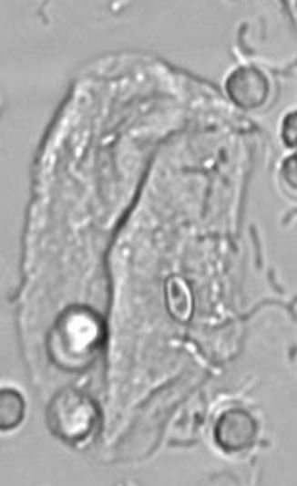 term image