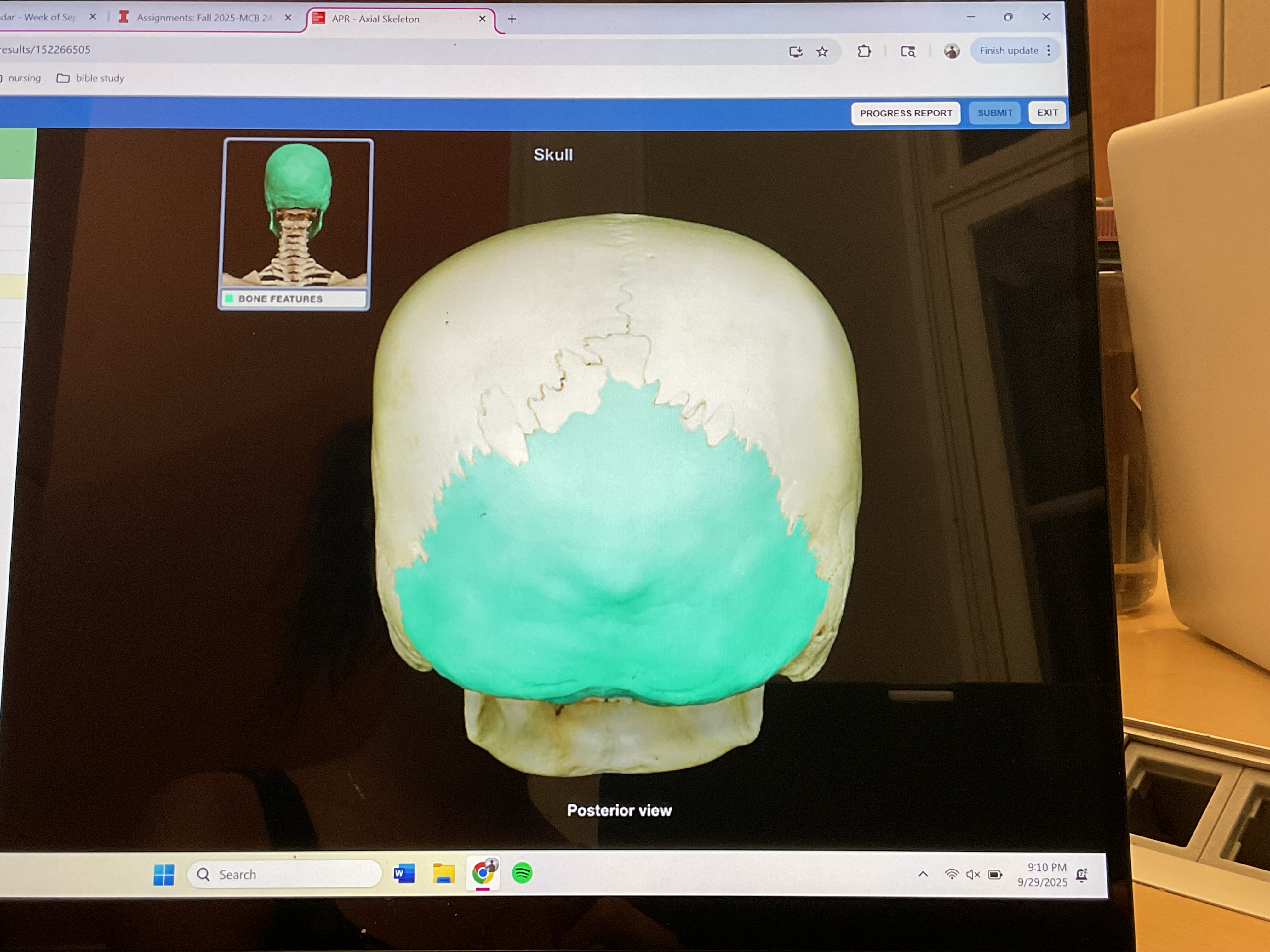 <p>Occipital bone </p>