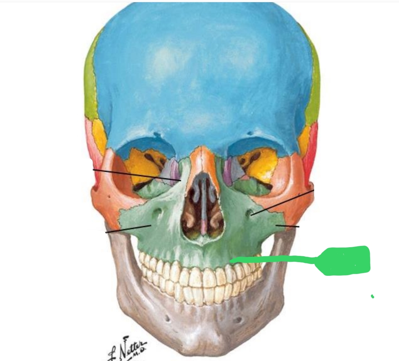 <p>Bone that supports/surrounds roots of teeth</p>