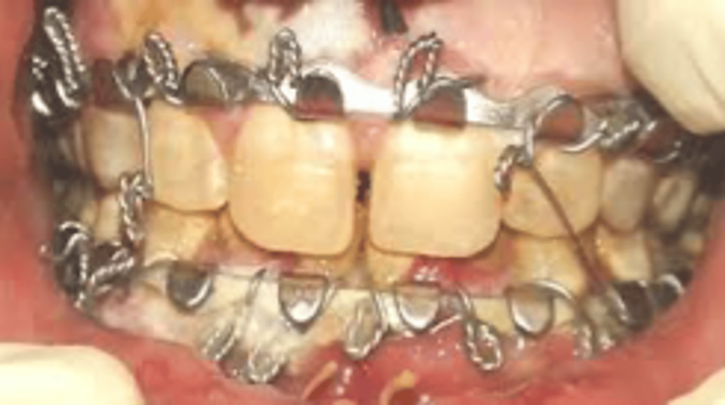 <p>ID the MMF device:</p>