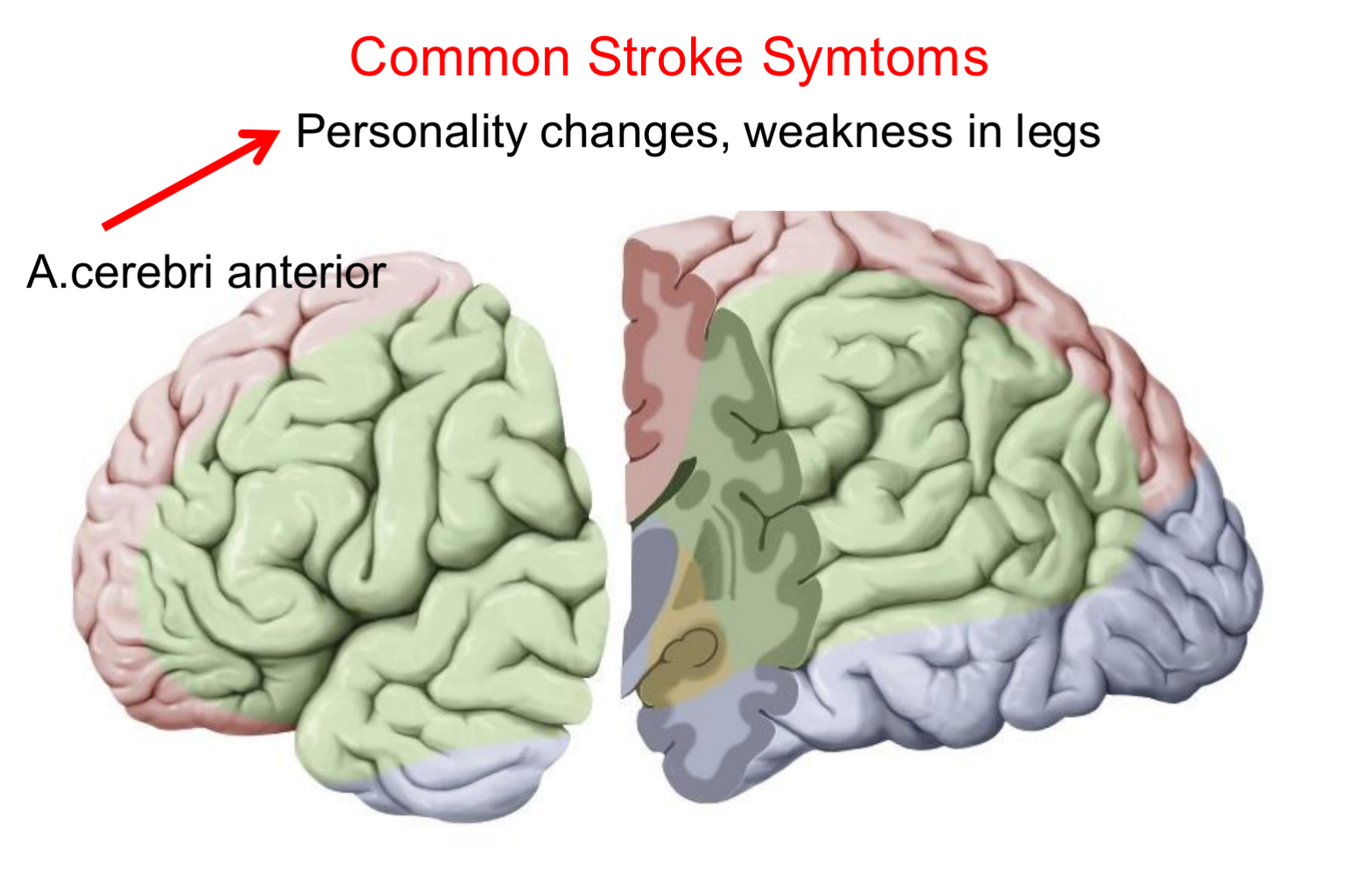 <ol><li><p>Personality changes</p></li><li><p>Weakness in legs </p></li></ol><p></p>