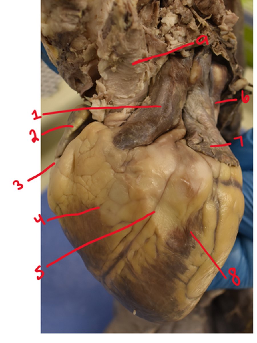 <p>What is structure #3</p>