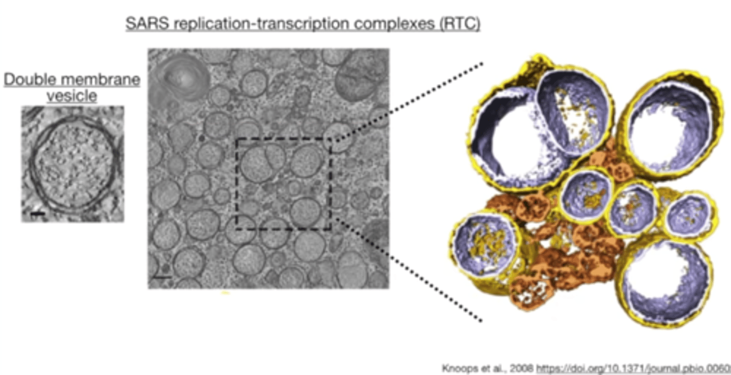 <p>- Double membrane vesicle</p><p>- SARS replication-transcription complexes (RTC)</p>