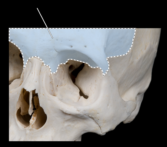 <p>Name this bone.</p><p>(Bones that form the orbit).</p>