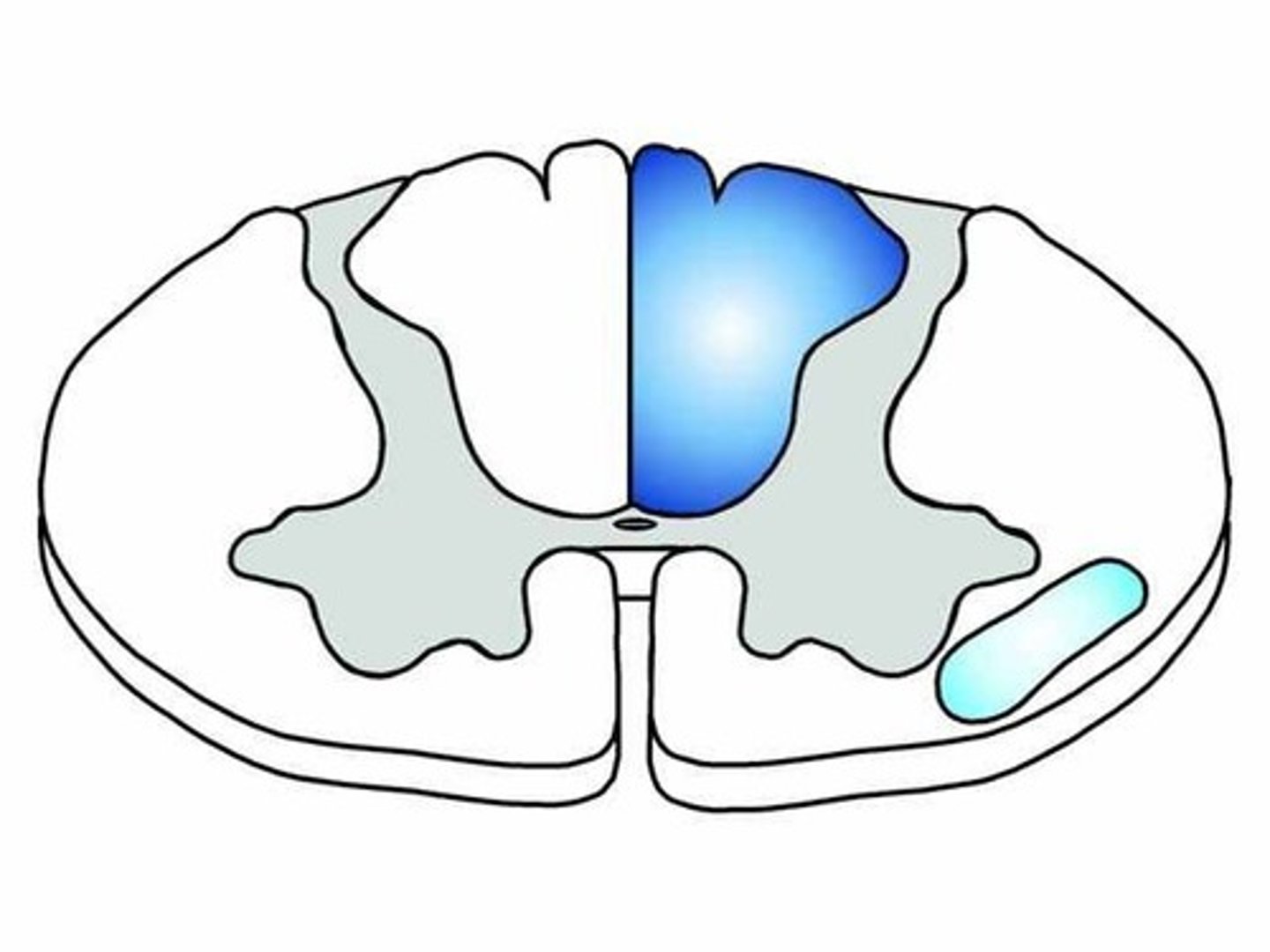<p>a somatosensory system that carries most of the pain information from the body to the brain</p>