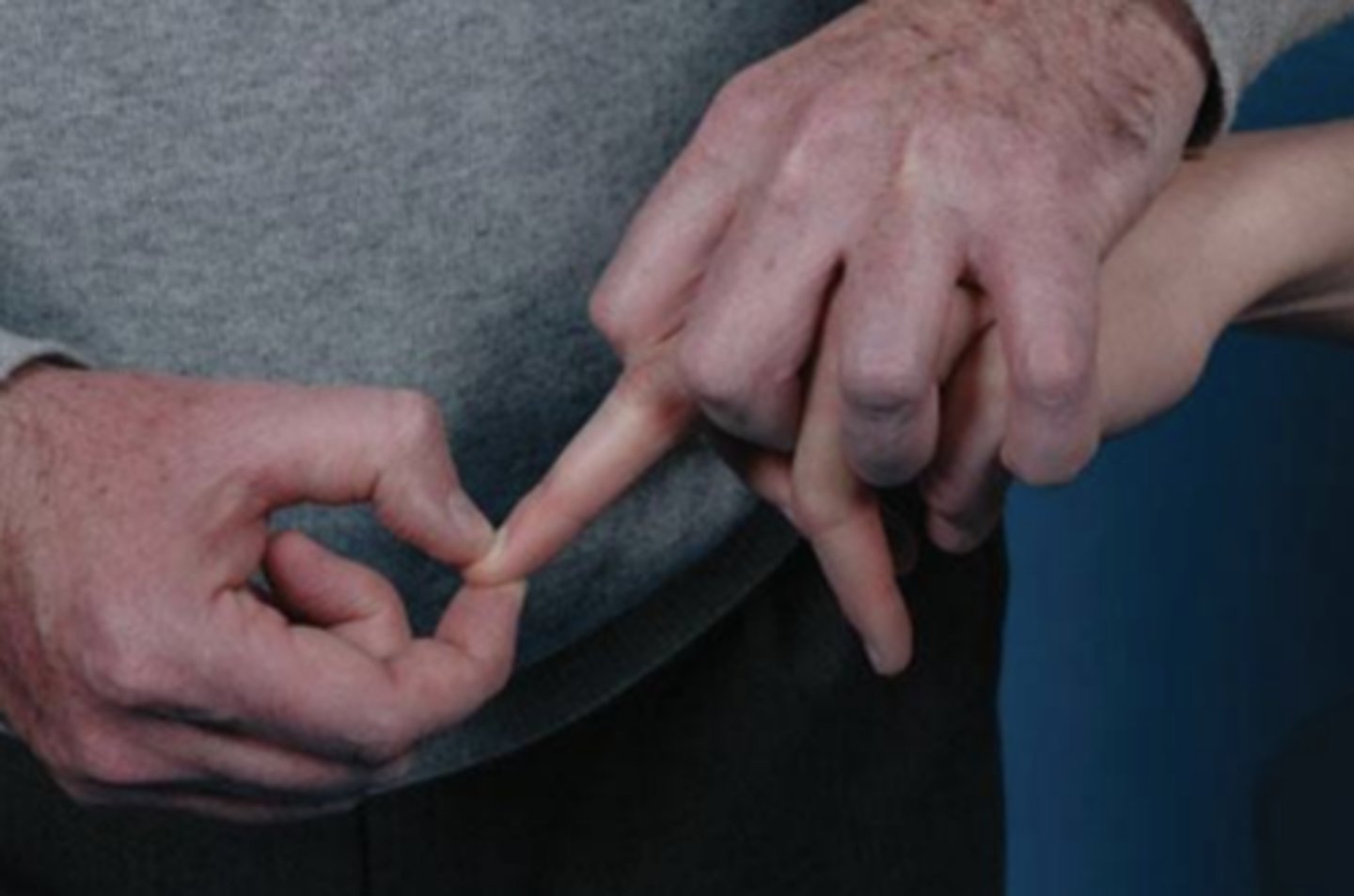 <p>- UMN dysfunction</p><p>- description: PT holds the pt's middle finger and briskly flicks the distal phalanx</p><p>(+): if interphalangeal joint of thumb of the same hand flexes/adducts. Fingers may also flex</p>