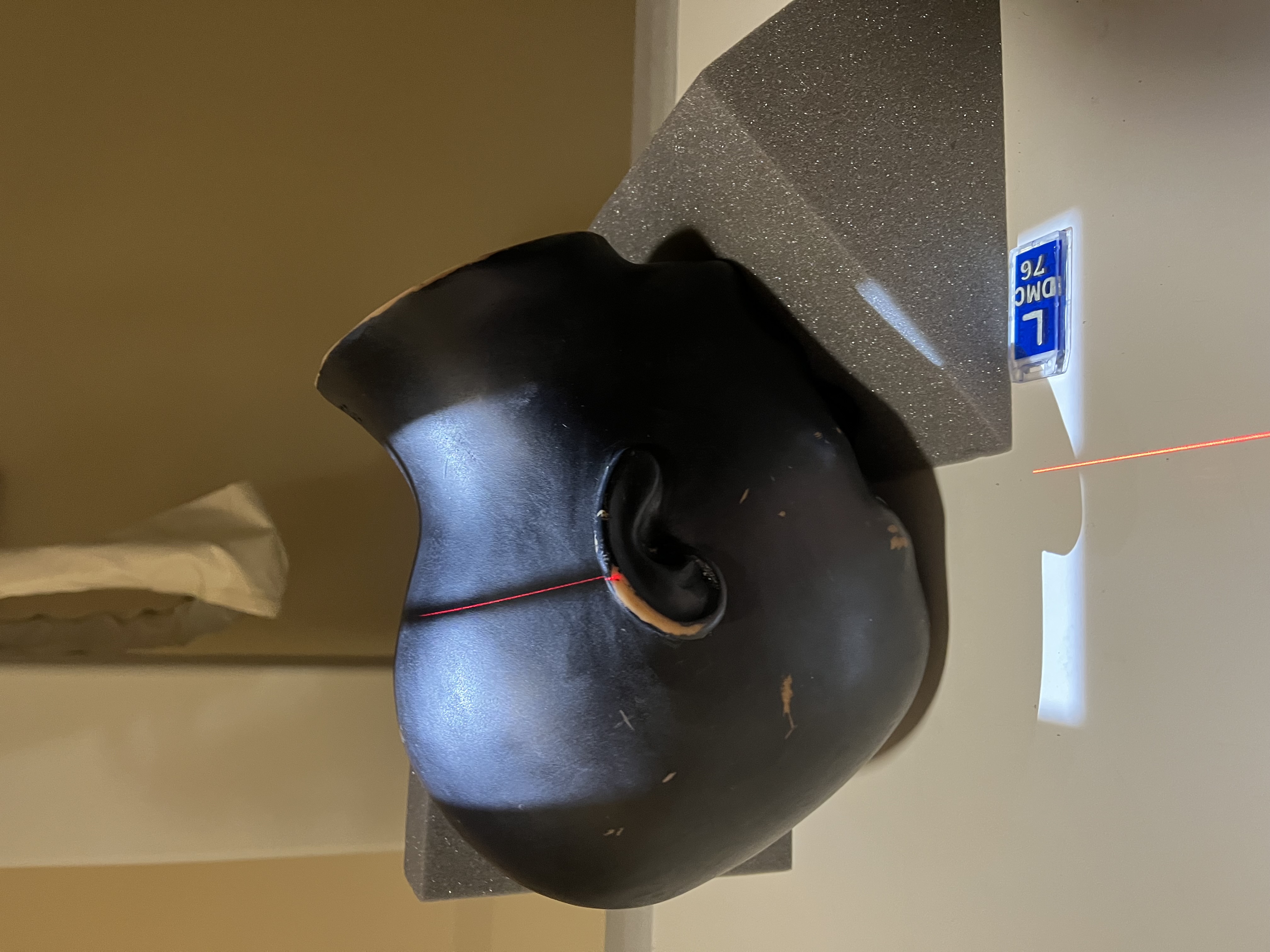<p>PA CALDWELL SINUS</p><p>SID</p><p style="text-align: start">COLLIMATION</p><p style="text-align: start">CR</p><p style="text-align: start">TECHNIQUE </p>