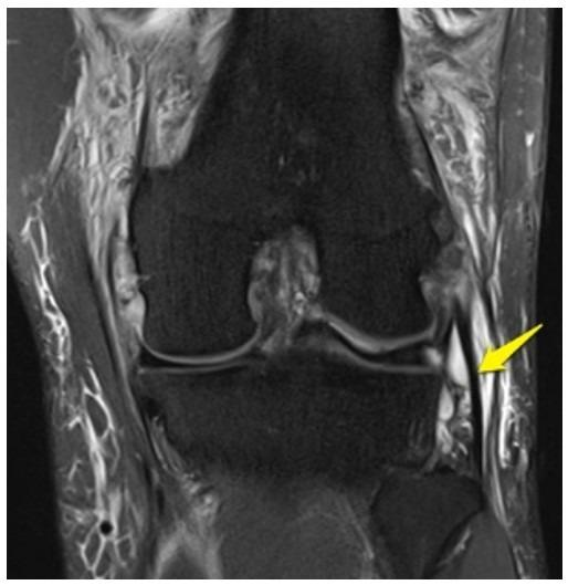 <p>What anatomy is the arrow pointing to?</p>