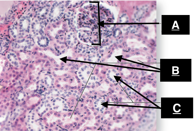 <p>Identify A </p>