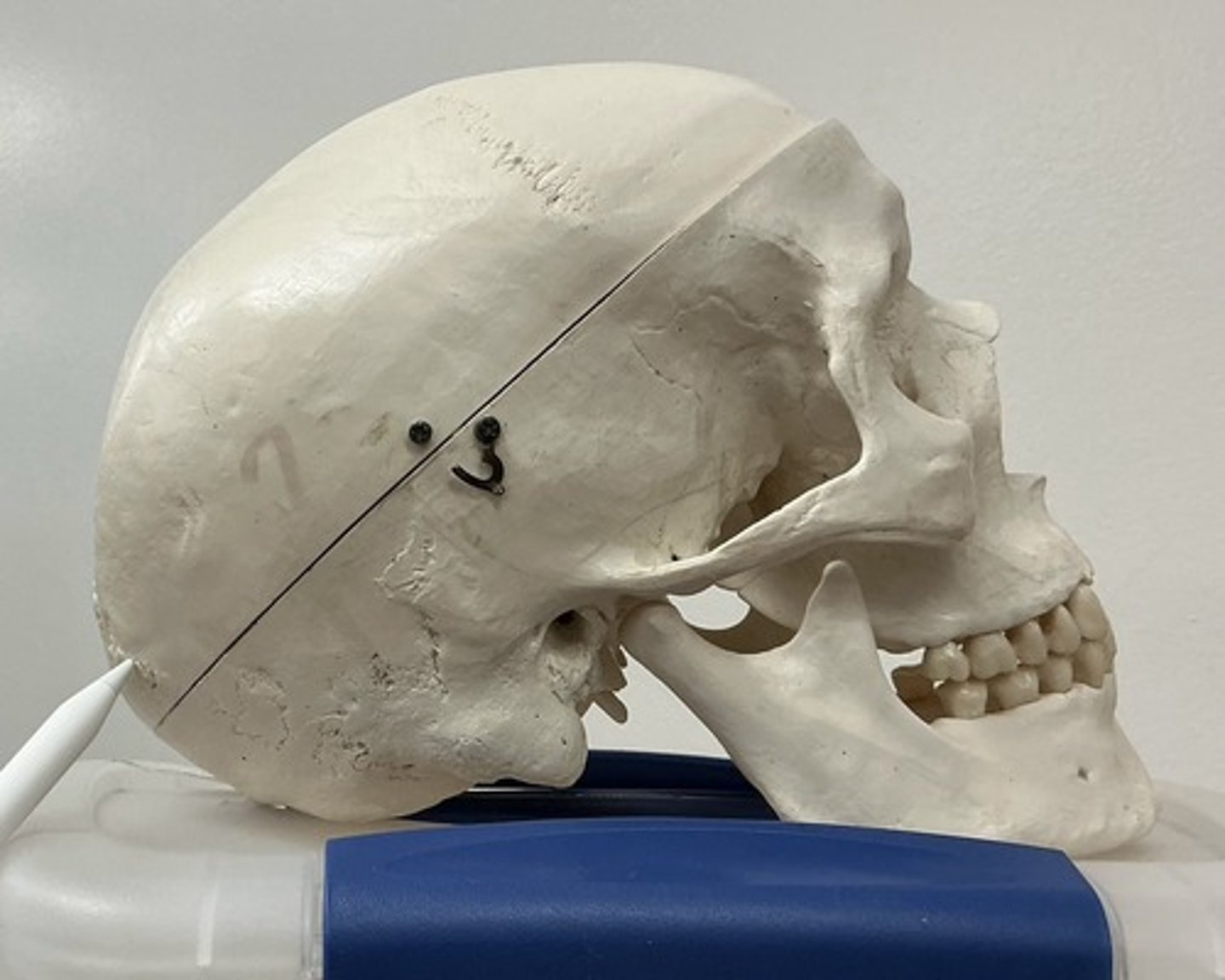 <p>What is the arrow pointing to?</p>