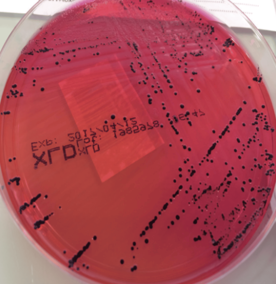 <p>Milieu : SS</p><p>Température : 37 degrés</p><p>Durée : 24h</p><p>Aspect : Translucides à centre noir </p>